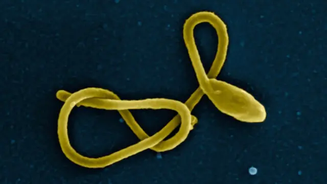 Micrographie électronique à balayage colorisée d'une seule particule filamenteuse du virus Ebola.