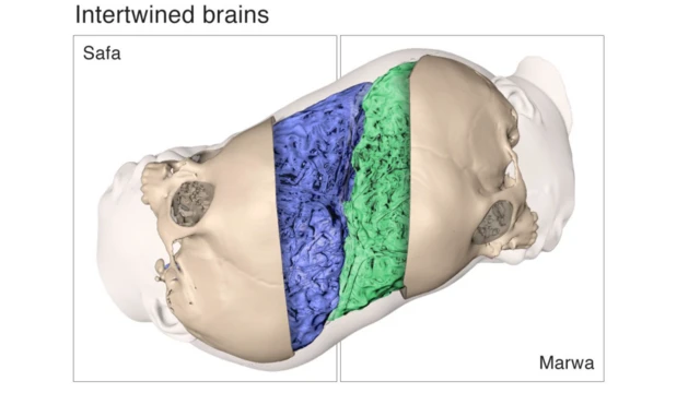 ሓባራዊ መትረባት ሳፋን ማርዋን 