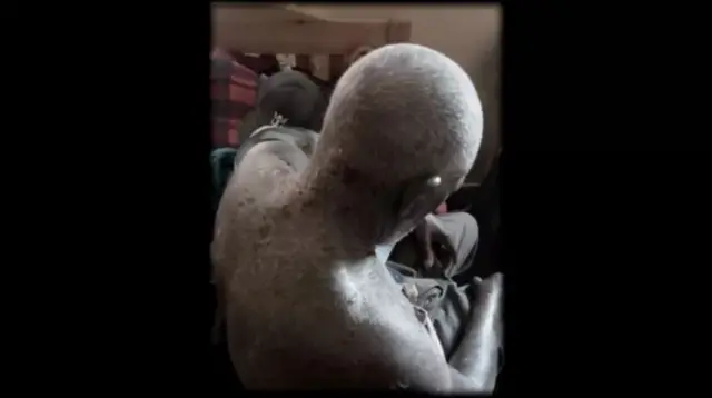 Xarumaha xannaanada waayeellada