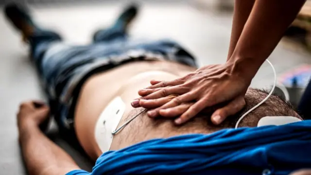 По истечении первых пяти лет после инфаркта половины из пациентов уже не будет в живых