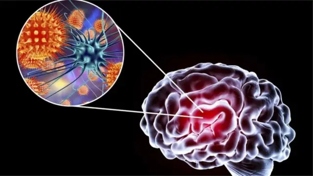 ज़ीका वायरस