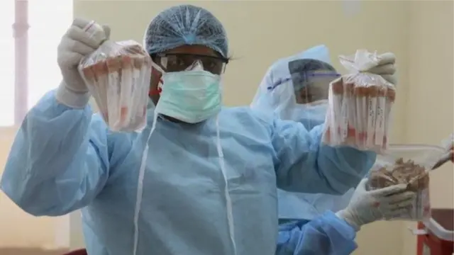 આ કીટના ઉપયોગ પર પાબંદી પછી ગુજરાત સરકાર એવી ટેસ્ટ કીટ ઉપલબ્ધ નથી કે જેનાથી જલ્દીથી પરિણામો જાણી શકાય.