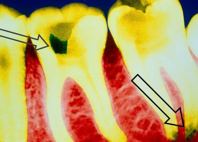 Eserese na-egosi eze kụwara akụwa