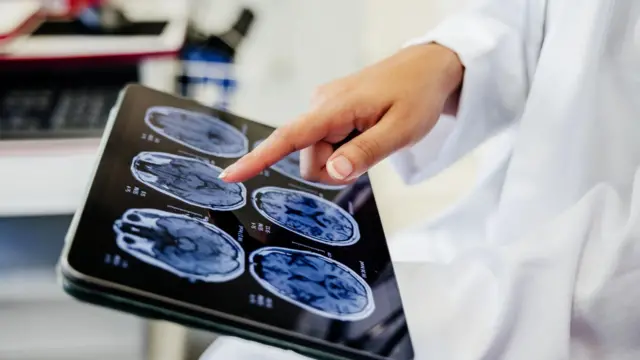 radiografías del cerebro en una tablet. Una mano señala el dispositivo. 