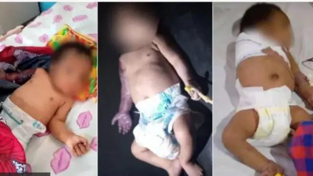 Aworan ọmọ ti wọn ge lapa