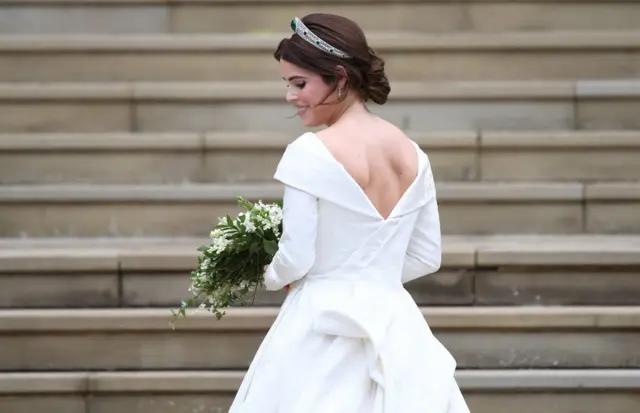 Princess eugenie wedding scar best sale