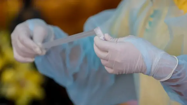 เก็บตัวอย่างตรวจหาเชื้อไวรัส