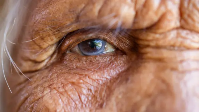 కన్నులో బూడిద రంగు వలయం