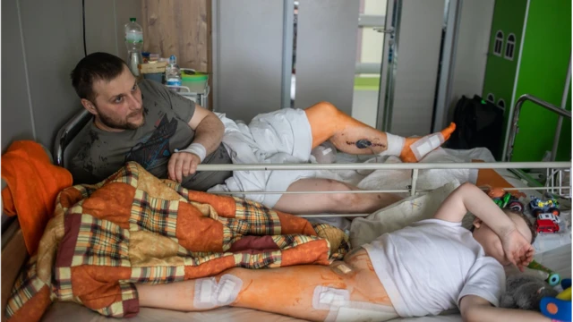 Сімʼя, яка постраждала від касетних боєприпасів у Чернігові