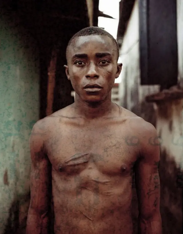 Молодой человек, покрытый шрамами