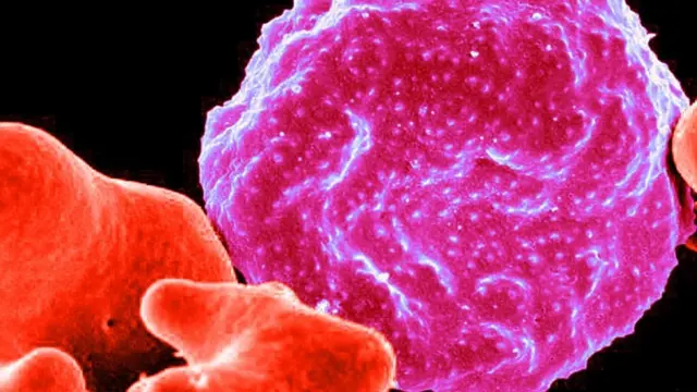 كريات دم حمراء مصابة بالملاريا