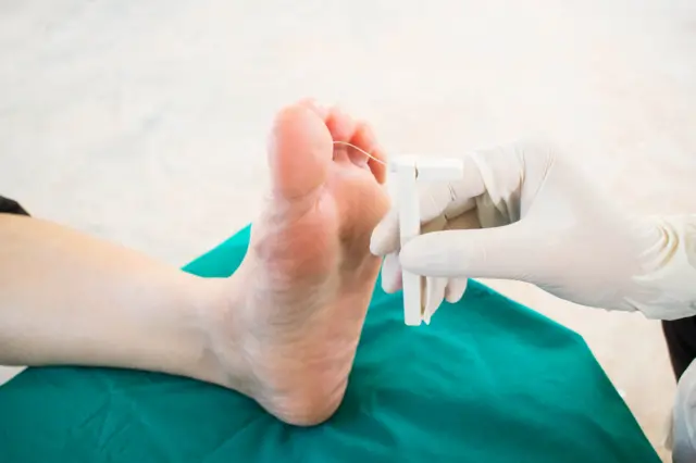 Prueba de sensación en el pie