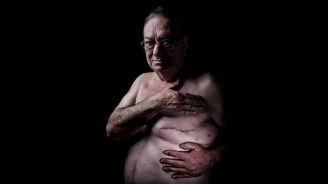 Все чаще звучат призывы признать необходимость разъяснения мужчинам важности профилактики рака молочной железы