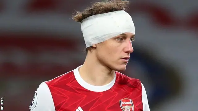 Arsenal defender David Luiz in action against Wolves after playing on with a head bandage following an accidental clash of heads with Raul Jimenez
