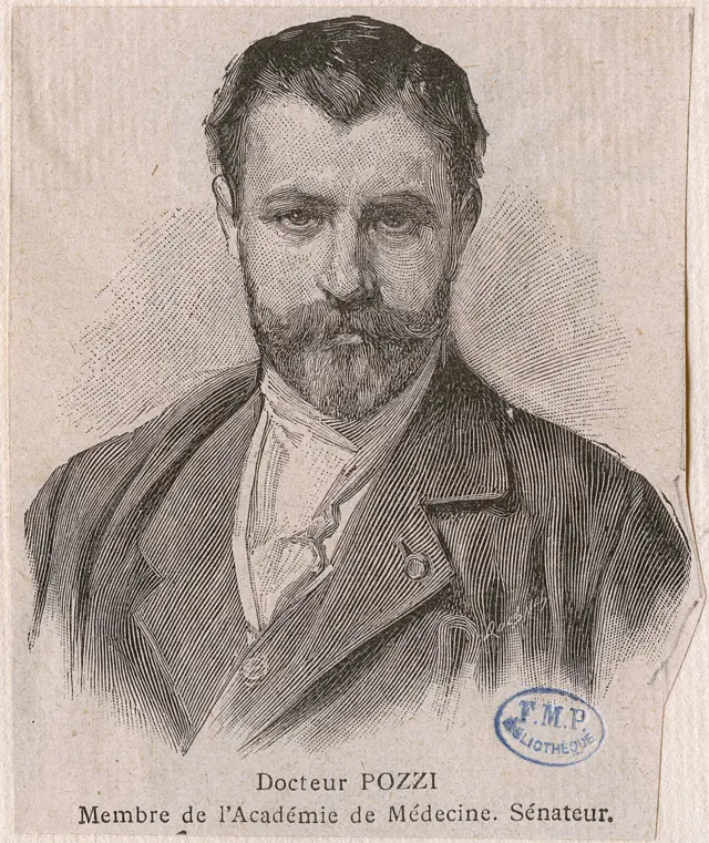 Samuel-Jean Pozzi