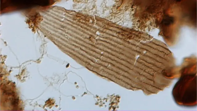 Una de las escamas bajo el microscopio