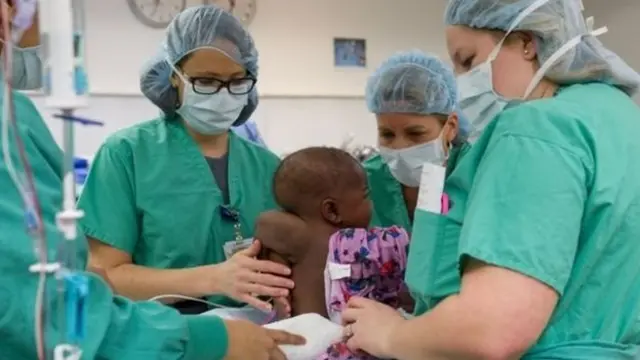 ผ่าตัดแยกแฝดปรสิต,ไอวอรีโคสต์,ผ่าตัดเด็ก,แฝดปรสิต