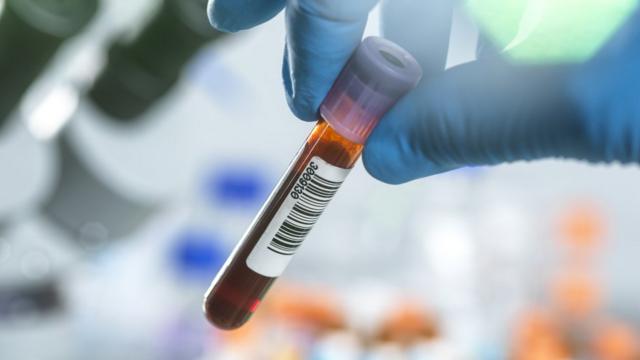 Sanguefazer jogo quina onlinetubofazer jogo quina onlinetestagem