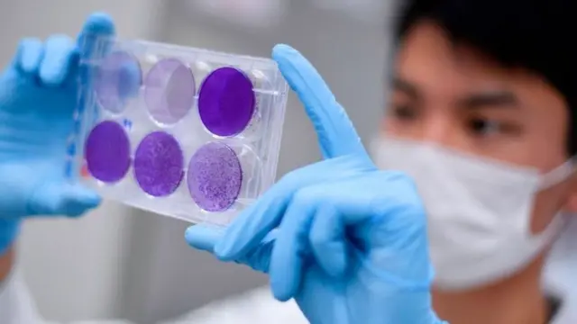 المرحلة القادمة من تجربة أكسفورد ستتضمن متطوعين من البرازيل التي تفشى فيها فيروس كورونا المستجد