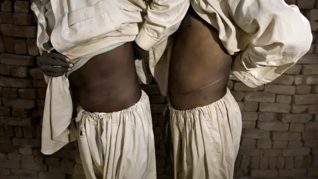 گردوں کی پیوند کاری