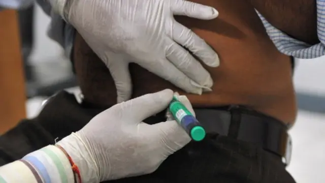 ကိုဗစ်ပျောက်ပြီး ဆီးချိုအလွန်တက်လာသူတွေရဲ့ ရောဂါဖြစ်တဲ့ပုံစံက ဆီးချိုရောဂါ အမှတ် တစ် ရော အမှတ် နှစ်ပါ ပုံစံ နှစ်မျိုးစလုံး တွေ့ရ