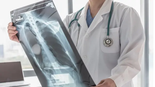 Médico observando una radiografía.