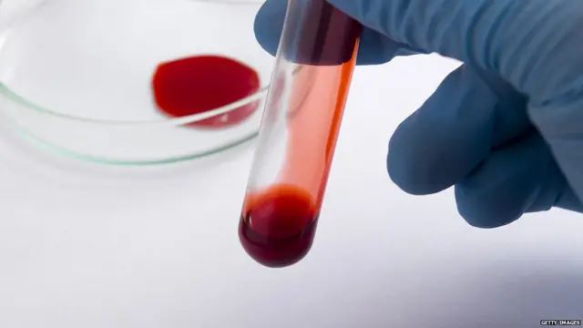 ਡੋਪ ਟੈਸਟ, ਪੰਜਾਬ, ਸਿਆਸਤ