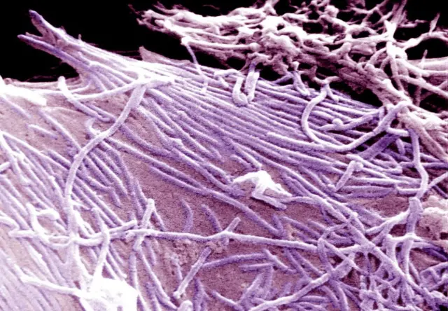 فيروس إيبولا القاتل