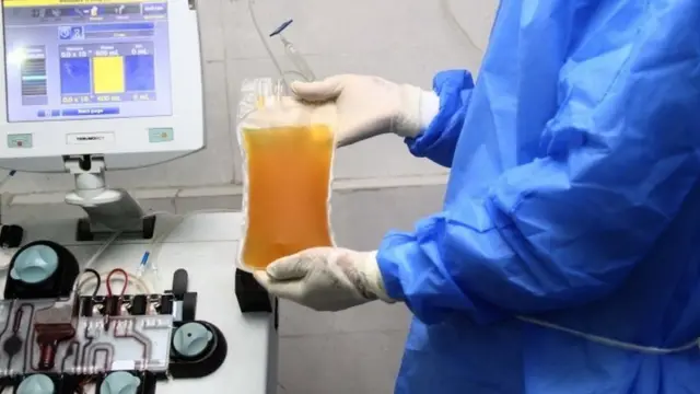 प्लाज़्मा