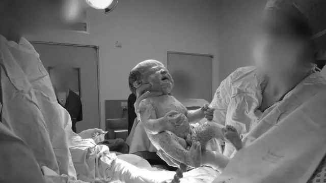 Девочка, родившаяся посредством кесарева сечения