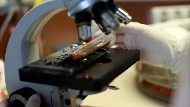 નિપા વાઇરસ