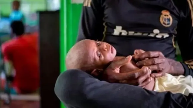 Kejadian Luar Biasa dinyatakan di sebuah wilayah di Papua karena kematian akibat gizi buruk.