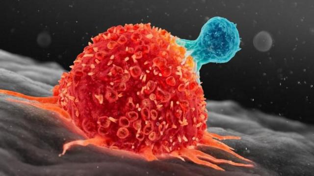 இந்தியாவில் அதிகரிக்கும் புற்றுநோயாளிகள்