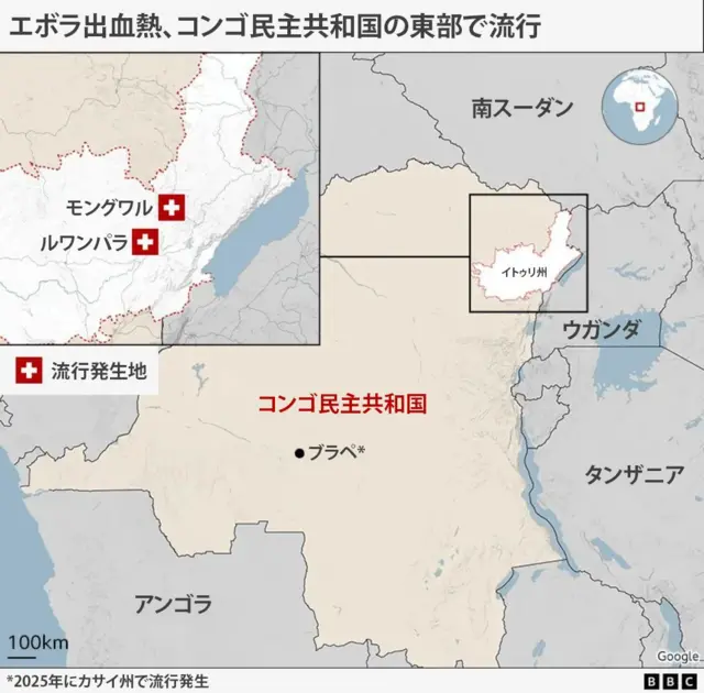エボラ出血熱が流行している場所を示しているコンゴ民主共和国の地図。東部イトゥリ州が左上部の囲み内で拡大され、モングワル、ルワンパラの2カ所が流行発生地として示されている。コンゴ民主共和国全体の地図では中部ブラペが示され、「2025年にカサイ州で流行発生」との注釈が付けられている。同国の周辺国として、南スーダン、ウガンダ、タンザニア、アンゴラが示されている