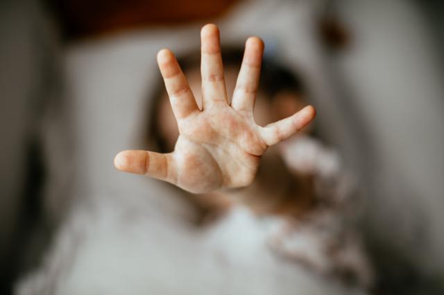 Menina mostrando a palma da mão