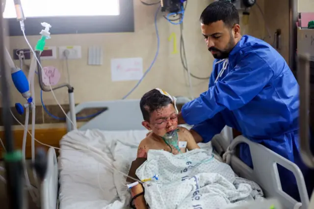 طبيب يقدم خدمات طبية لطفل مصاب في القصف