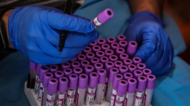 ரத்தம், அரிய வகை ரத்தம், புதிய ரத்த வகை கண்டுபிடிப்பு 