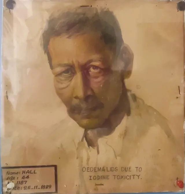 எழும்பூர் கண் மருத்துவமனை - 200 ஆண்டுகால மருத்துவ வரலாறு