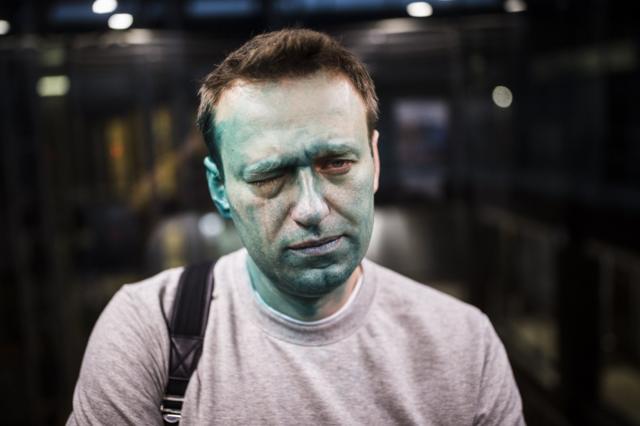  Навальный после того, как его облили зеленкой