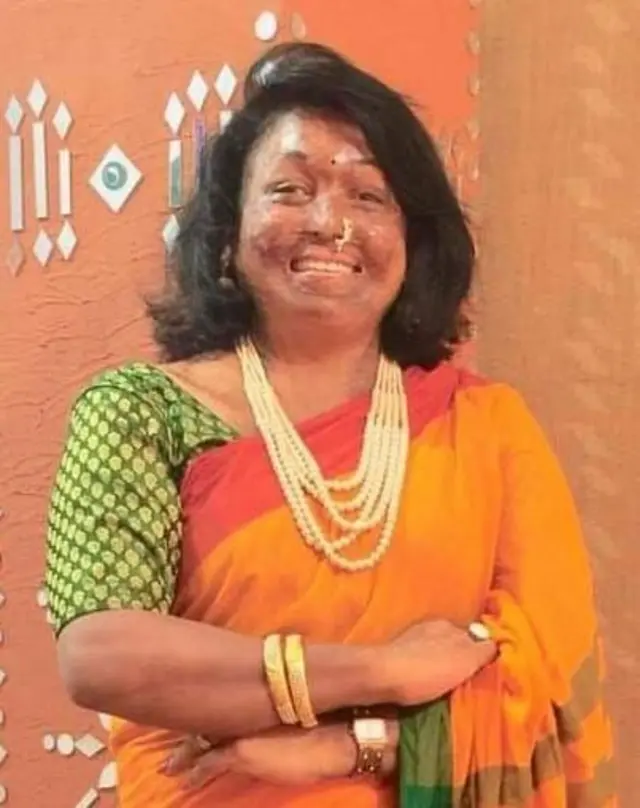 સ્નેહા જાવલેનું કહેવું છે કે લોકોએ ચામડીનું દાન કરવા બાબતે વિચાર કરવો જોઈએ. 