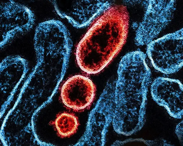 Enfekte olmuş bir VERO hücresi (mavi) ve Nipah virüsü parçacıkları (kırmızı)