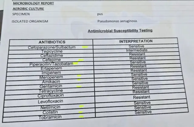 छालामा सङ्क्रमण गर्ने स्युडोमोनसले कुन एन्टिबायोटिकसँग कस्तो प्रतिक्रिया दिन्छ भनेर गरिएको एन्टिमाइक्रोबिअल ससेप्टिबिलिटी टेस्ट