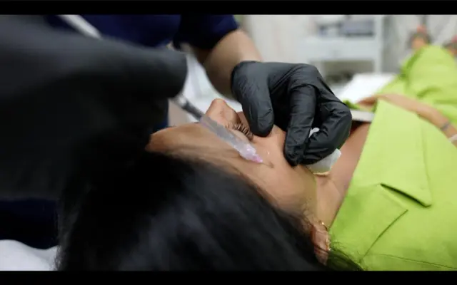 عملية تجميل