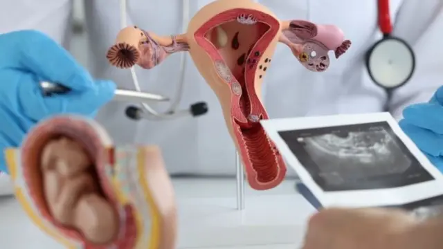 ਪੀਸੀਓਡੀ