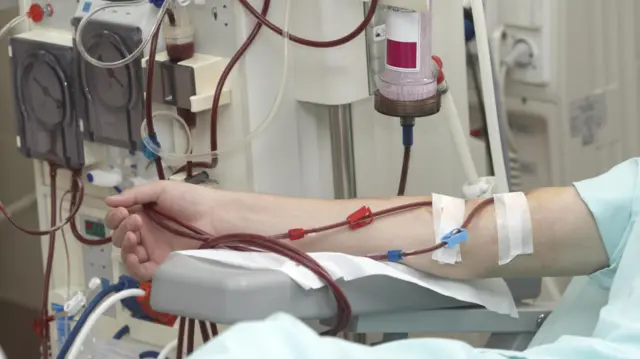 hemodialisis