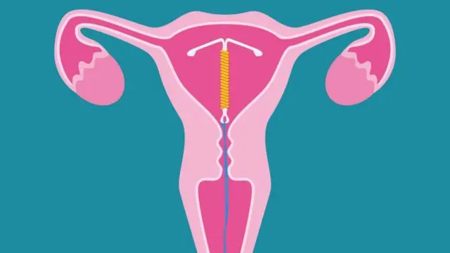 પ્રતીકાત્મક તસવીર