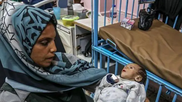 संयुक्त राष्ट्र का कहना है कि ग़ज़ा में भूख का संकट 'कभी इतना भयावह नहीं रहा था.'