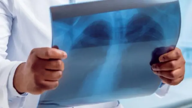 फोक्सोको एक्सरे