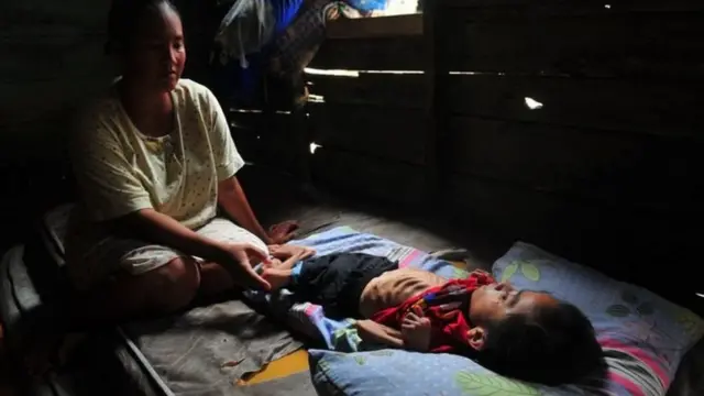 PBB, covid-19, virus corona, stunting