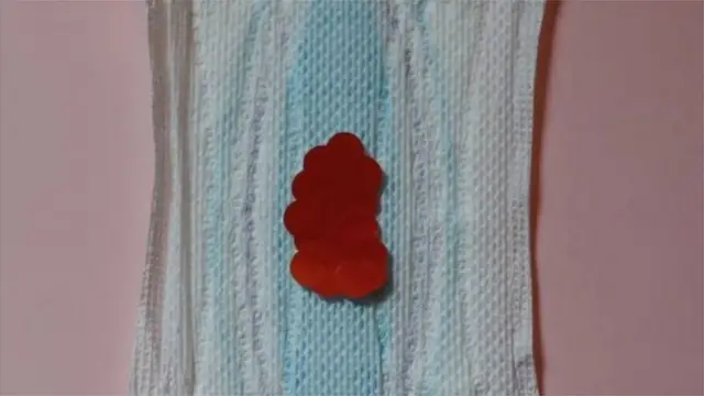 Dokita Brown sọ pe adinku le ba bi awọn obinrin ṣe n ni oyun iju, ti wọn ba le mojuto ilera wọn, nipa mimu adinku ba bi wọn ṣe n jẹ awọn ounjẹ to ni caffeine; tabi dena itọ ṣuga ati ẹjẹ riru, to fi mọ sisanra ju . O si tun ni ki obinrin tete bimọ le ran lọwọ.